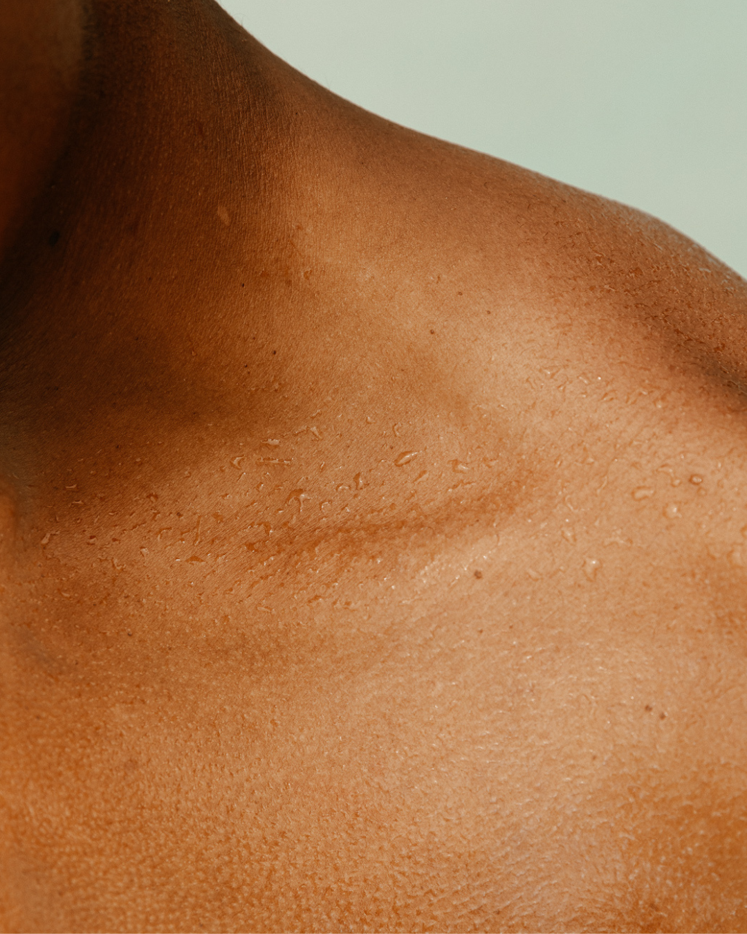 Why Natural Skincare Supports Long-Term Skin Resilience